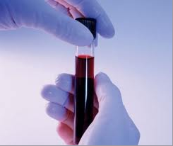 анализ крови при панкреатите